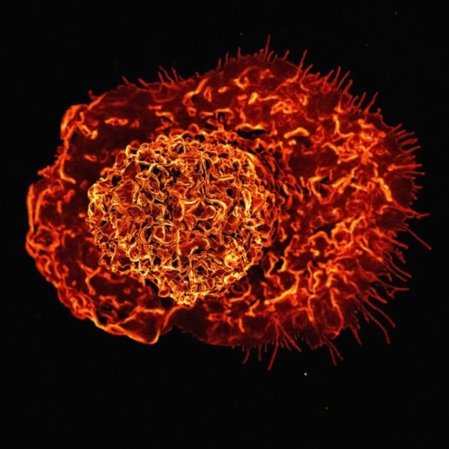 Une méthode innovante du CHUV pour “modéliser” les maladies auto-immunes — un espoir pour l’encéphalite, la sclérose en plaques et autres pathologies invisibles