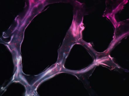 Un gel injectable du MIT pourrait révolutionner la réparation des lésions nerveuses