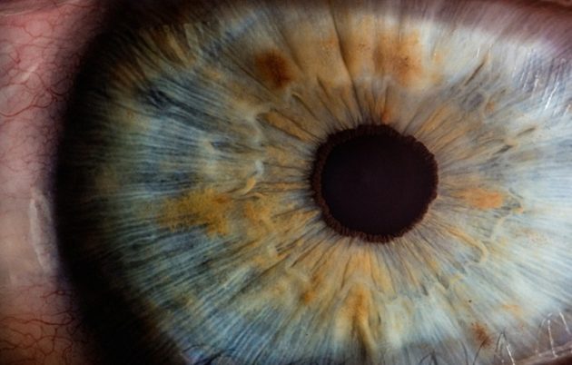 Un œil bionique pour redonner une forme de vision aux personnes aveugles