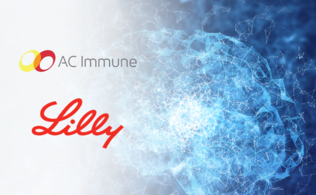 Alzheimer : quand l’innovation de la Health Valley franchit une nouvelle étape