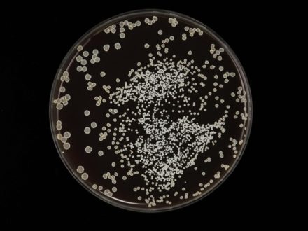 Le confinement mécanique rend certaines bactéries plus tolérantes aux antibiotiques