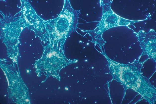 Un biomarqueur sanguin pourrait mieux prédire la progression de la sclérose en plaques