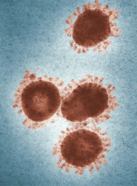 Quand l’IA crée des virus bactériens qui n’existent pas dans la nature