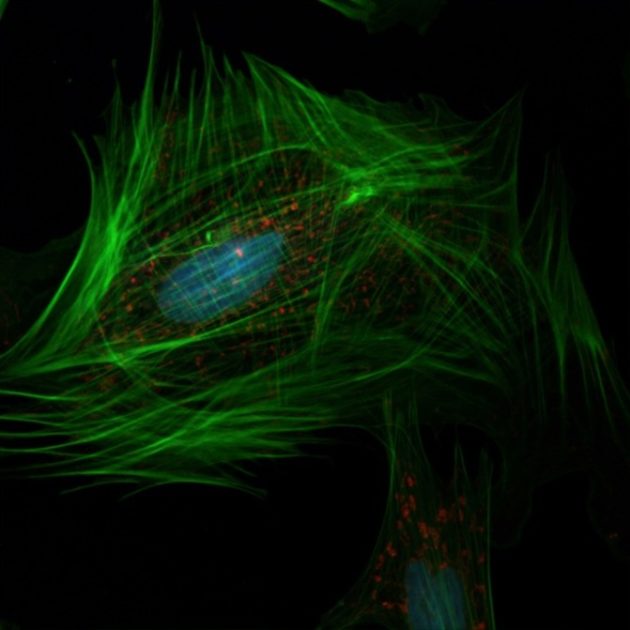 L’EPFL filme l’intérieur des cellules vivantes en super-résolution