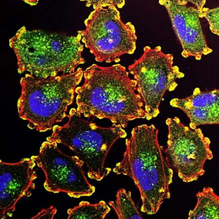 Une nouvelle méthode permet de retracer l’activité passée des cellules